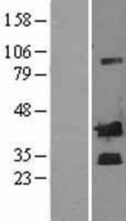 Novus Biologicals&trade;&nbsp;Corticotropin Releasing Factor Overexpression Lysate