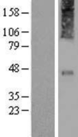 Novus Biologicals&trade;&nbsp;CRHR2/CRF2 Overexpression Lysate