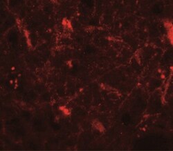 Corticotropin Releasing Factor Antibody - BSA Free, Novus Biologicals 0.1mg;