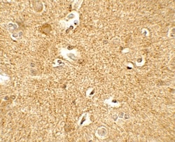 Corticotropin Releasing Factor Antibody - BSA Free, Novus Biologicals 0.1mg;