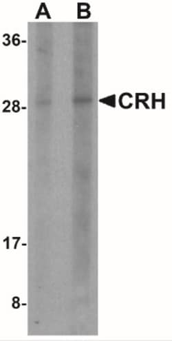 Corticotropin Releasing Factor Antibody - BSA Free, Novus Biologicals 0.1mg;