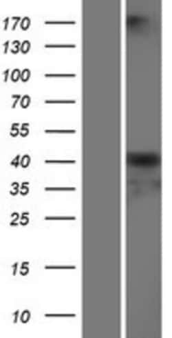 Novus Biologicals&trade;&nbsp;Serpin A6/Cortisol Binding Globulin Overexpression Lysate
