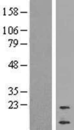 Novus Biologicals&trade;&nbsp;Cortistatin Overexpression Lysate