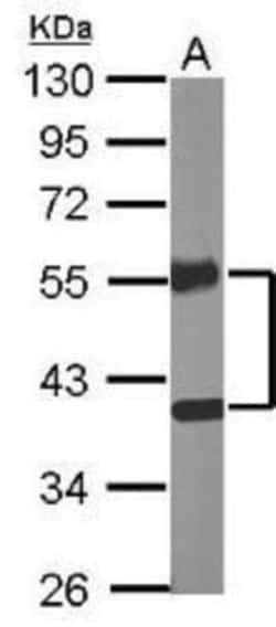 COUP-TF II/NR2F2 Antibody, Novus Biologicals 0.1mL; Unlabeled:Antibodies,