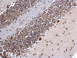 COUP-TF I/NR2F1 Antibody, Novus Biologicals 100 &mu;L | Buy Online | Novus Biologicals | Fisher Scientific