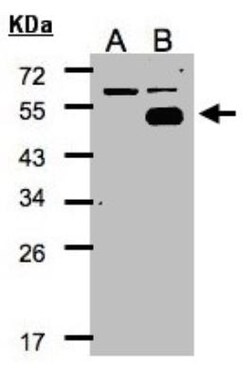 COUP-TF I/NR2F1 Antibody, Novus Biologicals 100 &mu;L | Buy Online | Novus Biologicals | Fisher Scientific