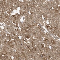 Semenogelin I Antibody, Novus Biologicals:Antibodies:Primary Antibodies