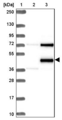 ANKRD45 Antibody, Novus Biologicals:Antibodies:Primary Antibodies