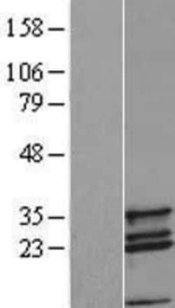 Novus Biologicals&trade;&nbsp;COX11 Overexpression Lysate