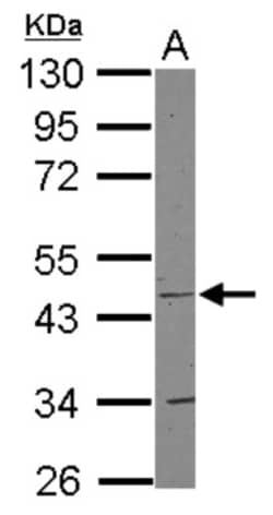 COX15 Antibody, Novus Biologicals 0.1mL; Unlabeled:Antibodies, Polyclonal