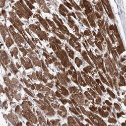 COX15 Antibody, Novus Biologicals:Antibodies:Primary Antibodies