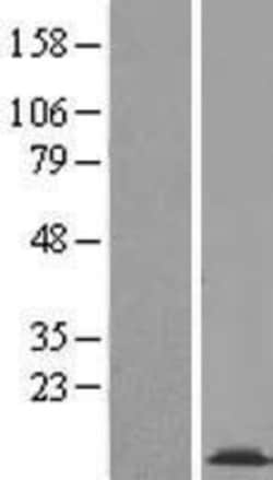 Novus Biologicals&trade;&nbsp;COX16 Overexpression Lysate