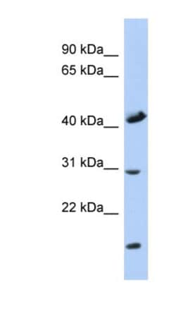 COX18 Antibody, Novus Biologicals:Antibodies:Primary Antibodies