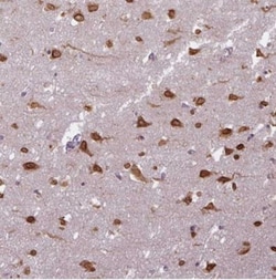COX18 Antibody, Novus Biologicals:Antibodies:Primary Antibodies