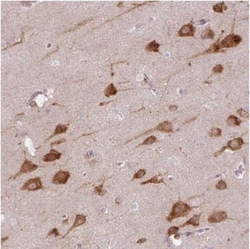 COX18 Antibody, Novus Biologicals 0.1mL; Unlabeled:Antibodies, Polyclonal