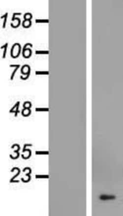 Novus Biologicals&trade;&nbsp;COX19 Overexpression Lysate
