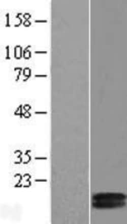 Novus Biologicals&trade;&nbsp;COX5b Overexpression Lysate