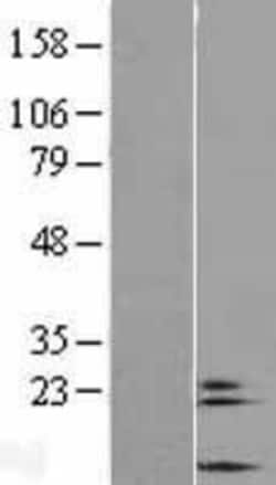 Novus Biologicals&trade;&nbsp;COX6A2 Overexpression Lysate