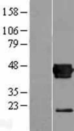 Novus Biologicals&trade;&nbsp;CXADR Overexpression Lysate