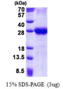 Novus Biologicals&trade;&nbsp;Recombinant Human CXADR His Protein