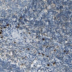 CPA3 Antibody, Novus Biologicals 25 &mu;L | Buy Online | Novus Biologicals | Fisher Scientific