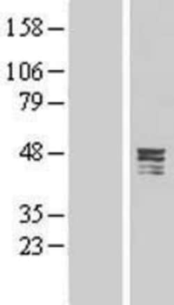 Novus Biologicals&trade;&nbsp;CPA5 Overexpression Lysate