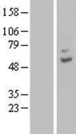 Novus Biologicals&trade;&nbsp;CPA6 Overexpression Lysate