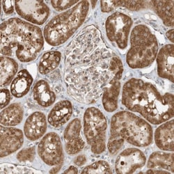 CPAMD8 Antibody, Novus Biologicals:Antibodies:Primary Antibodies