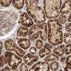 CPAMD8 Antibody, Novus Biologicals:Antibodies:Primary Antibodies