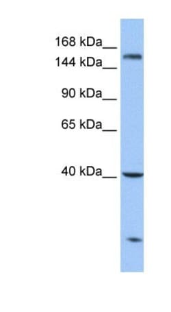 CPD Antibody, Novus Biologicals 100 &mu;L | Buy Online | Novus Biologicals | Fisher Scientific