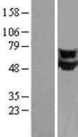 Novus Biologicals&trade;&nbsp;CPEB1 Overexpression Lysate