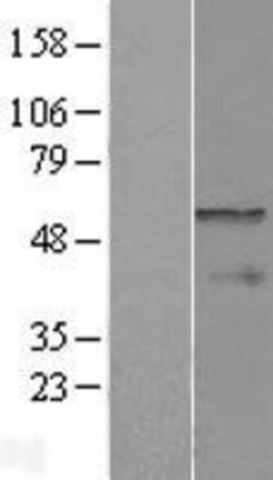 Novus Biologicals&trade;&nbsp;CPEB1 Overexpression Lysate