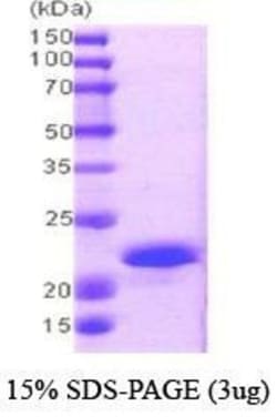 Novus Biologicals&trade;&nbsp;Recombinant Human CPI17 alpha His Protein
