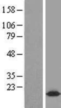 Novus Biologicals&trade;&nbsp;Complexin-2 Overexpression Lysate