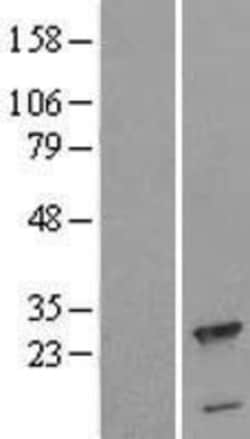 Novus Biologicals&trade;&nbsp;CPLX3 Overexpression Lysate