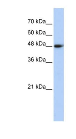 CPN1 Antibody, Novus Biologicals:Antibodies:Primary Antibodies