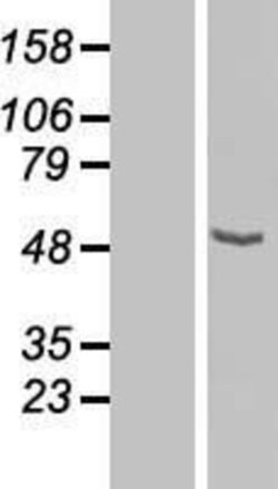 Novus Biologicals&trade;&nbsp;CPN1 Overexpression Lysate
