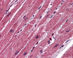 CPN1 Antibody, Novus Biologicals 0.05mg; Unlabeled:Antibodies, Polyclonal