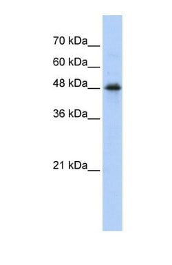 CPN1 Antibody, Novus Biologicals 0.05mg; Unlabeled:Antibodies, Polyclonal