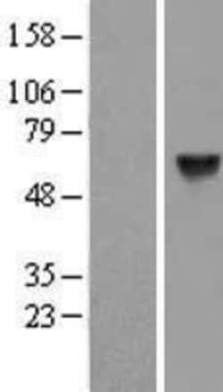Novus Biologicals&trade;&nbsp;CPNE1 Overexpression Lysate