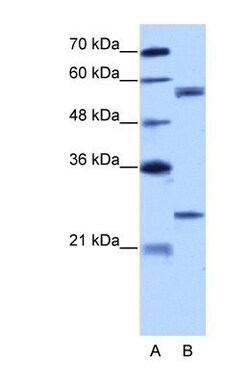CPNE1 Antibody, Novus Biologicals 0.1mg; Unlabeled:Antibodies, Polyclonal
