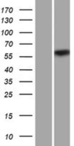 Novus Biologicals&trade;&nbsp;CPNE2 Overexpression Lysate