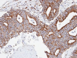 CPNE3 Antibody, Novus Biologicals 0.1mL; Unlabeled:Antibodies, Polyclonal