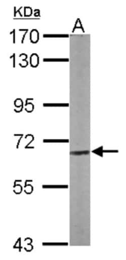 CPNE3 Antibody, Novus Biologicals 0.1mL; Unlabeled:Antibodies, Polyclonal
