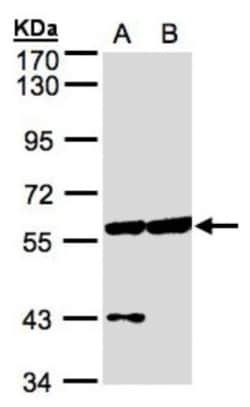 CPNE3 Antibody, Novus Biologicals 0.1mL; Unlabeled:Antibodies, Polyclonal