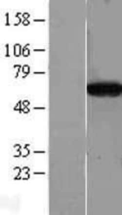 Novus Biologicals&trade;&nbsp;CPNE4 Overexpression Lysate