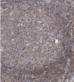 CPNE5 Antibody, Novus Biologicals 25 &mu;L | Buy Online | Novus Biologicals | Fisher Scientific