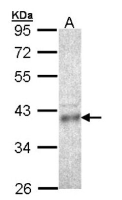 CPOX Antibody, Novus Biologicals 0.1mL; Unlabeled:Antibodies, Polyclonal