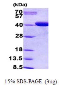 Novus Biologicals&trade;&nbsp;Recombinant Human CPOX His Protein