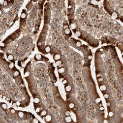 CPR8 Antibody, Novus Biologicals:Antibodies:Primary Antibodies